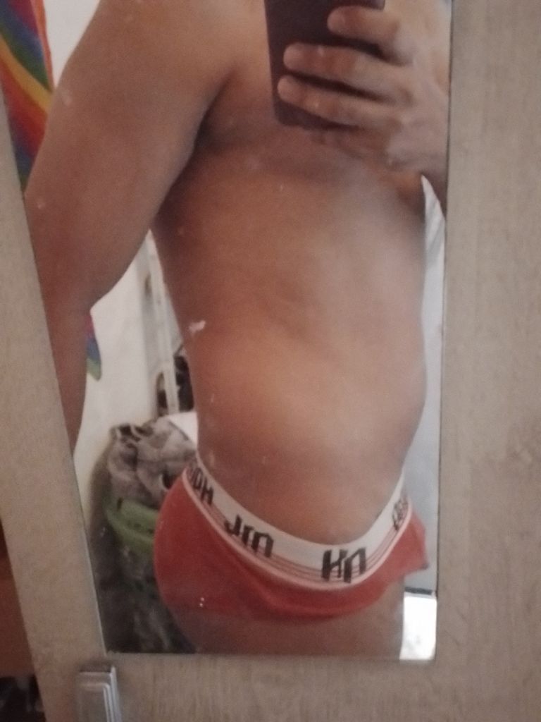 Foto 4 de Versátil Foguento